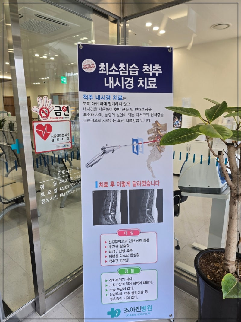 목디스크 치료방법 경추내시경시술 어떤 분들에게 추천할까요?