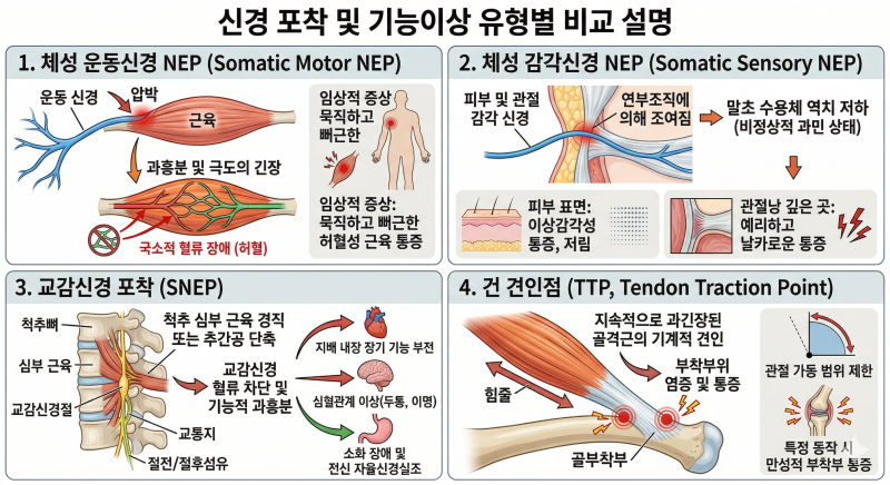 자율신경 조절을 위한 주사 치료 SNEPI(Sympathetic Nerve Entrapment Point Injection) 스네피