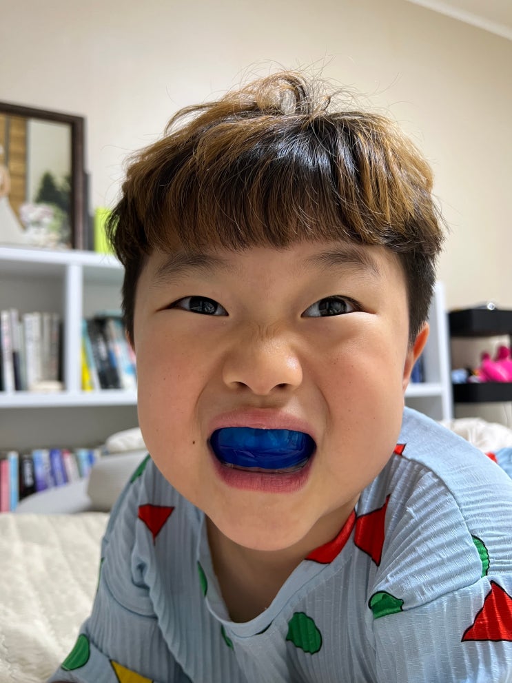  6세 반대교합 교정 후기, 프리올소(Pre-Ortho) 3주 만에 나타난 놀라운 변화 (비용 및 시기 팁)