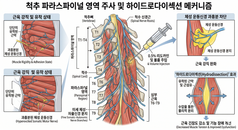 자율신경 조절을 위한 주사 치료 SNEPI(Sympathetic Nerve Entrapment Point Injection ...