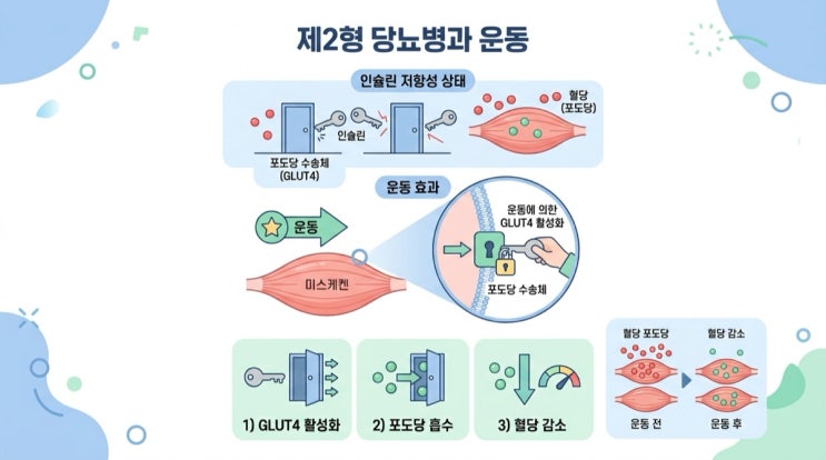 제2형당뇨, 운동 이렇게 하세요
