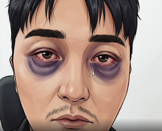  잠오는약 효과 있을까? 불면증 원인 부터 불면증약 종류 알아보자