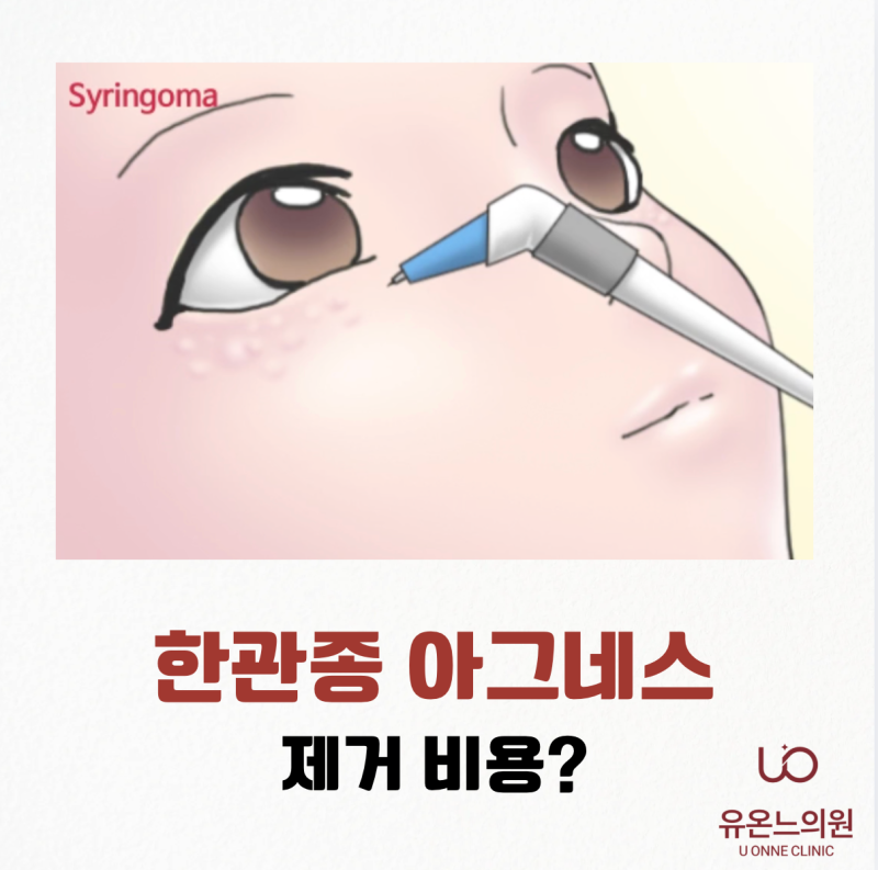 눈밑 한관종 제거 비용 얼마인가요? 아그네스로 근본 원인 치료