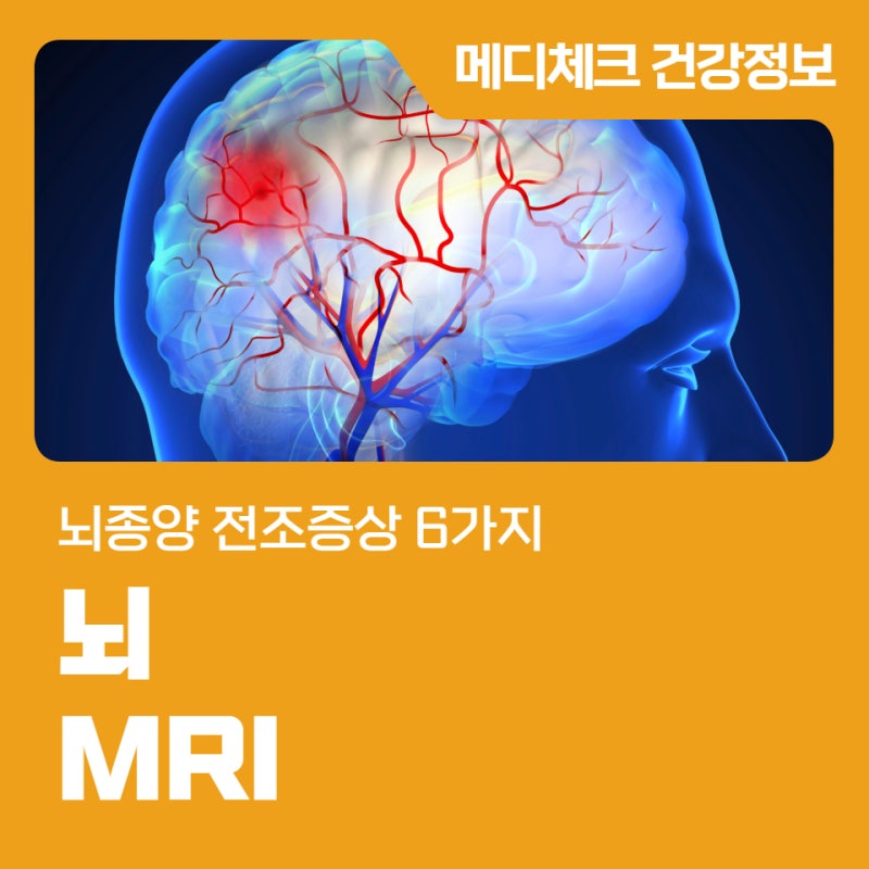 광주 MRI 뇌검사 뇌종양 전조증상 6가지
