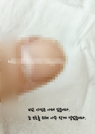 올리브영 반디 큐티클 케어 키트 솔직 후기｜셀프 손톱 관리 전후 사진 공개