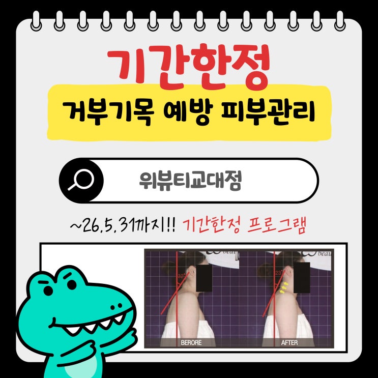  거북목있다면 <기간한정> 발로하는 거부기목 예방 피부관리 어때?
