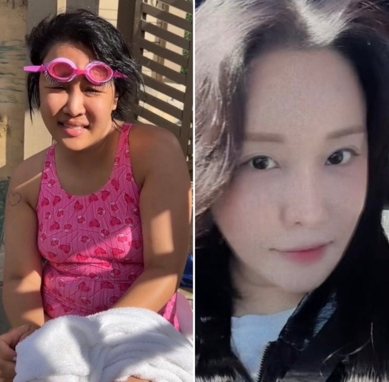 이제야 좀 사람 코 같네" 성형 한 달 차 랄랄, 4kg 빼고 나타나니 '이 사람'인 줄?