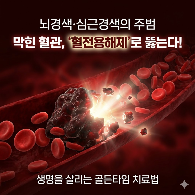  혈전 제거 방법, 막힌 혈관 그대로 두면 시한폭탄? 골든타임 사수하는 두 가지 핵심 치료법 총정리!