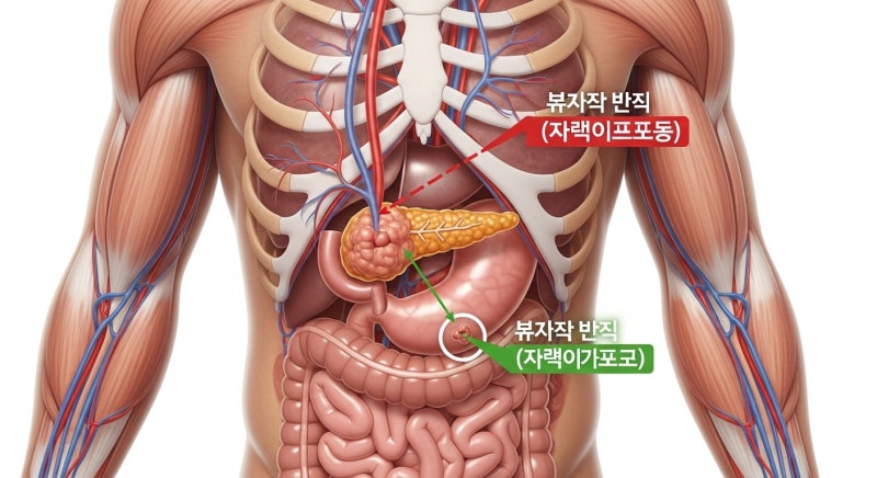 11편) 췌장암 치료 선택 기준: 수술 vs 항암, 내 상황에 맞는 결정 방법 (생존율 차이)