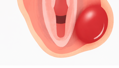 바르톨린 낭종?! 잦은 재발에 대한 대처는?