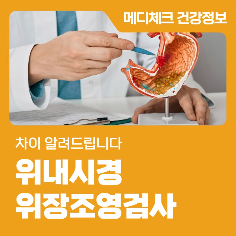 광주 건강검진협회 위내시경 vs 위장조영검사 차이
