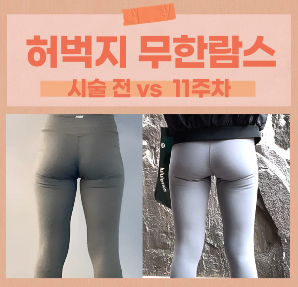  한성대입구역 허벅지 람스 11주 차 : 다리 사이에 틈이 생겼습니다 (쓸림 안녕!)