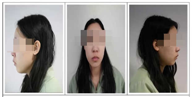  강북 모텔 살인 사건, 김소영 가족도 처벌 가능할까?