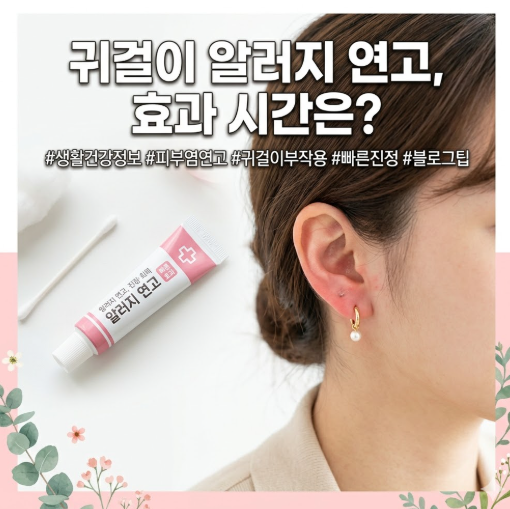 귀걸이 알러지 연고 바르면 언제까지 가나요? 효과 시간 정리
