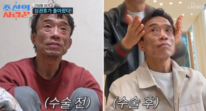  심권호 근황, 간암 수술 극복하고 건강해졌다
