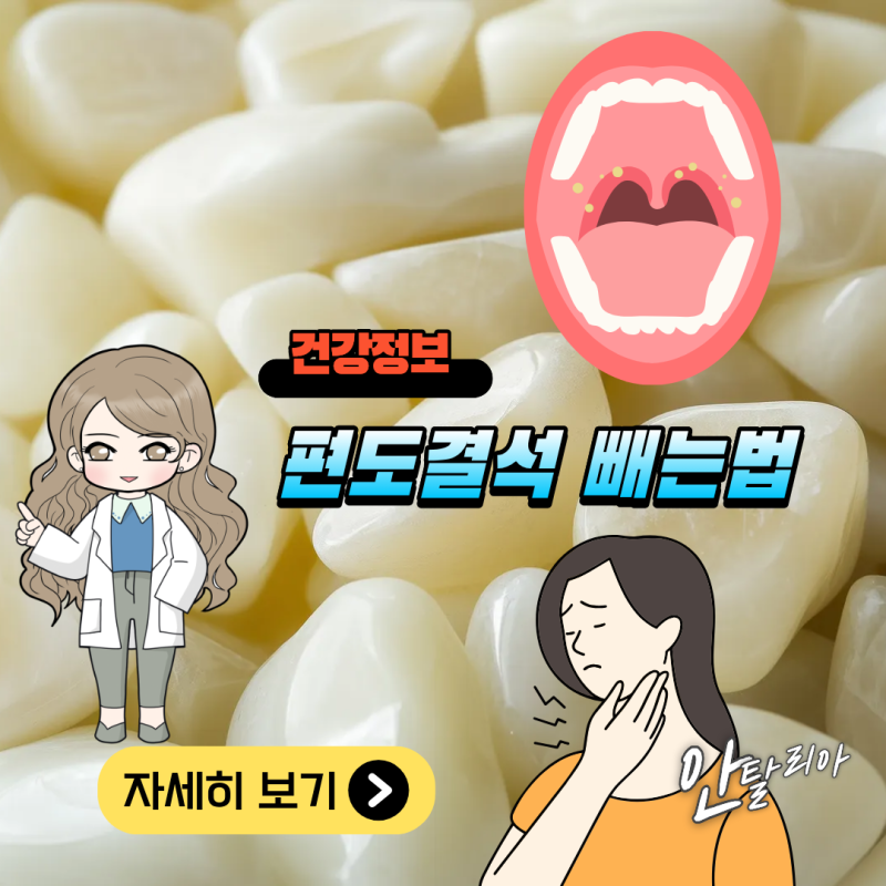 편도결석빼는법 과 가글 효과 제대로 알아보기