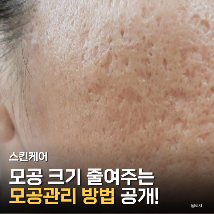  "모공이 넓어지는 진짜 이유, 대부분 이 습관 때문이에요. 모공관리 방법 공개!"