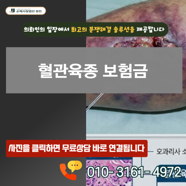  혈관육종 보험금, C44라며 20%만 받으셨나요? 병리보고서 하나로 100% 뒤집는 결정적 기준