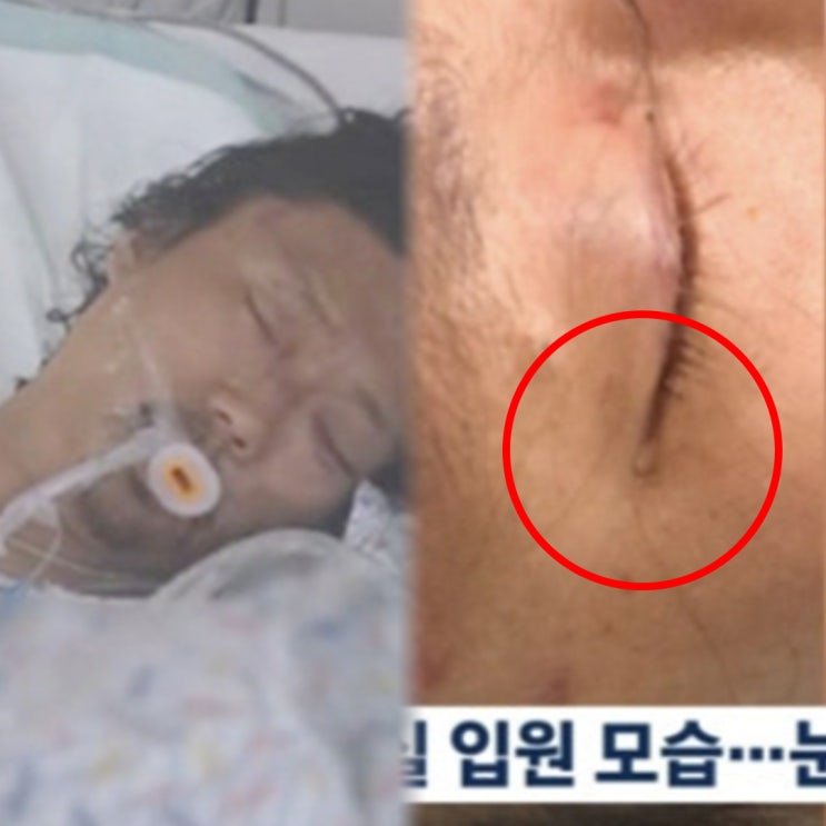 "눈가에 맺힌 눈물?!" 故 <b>김창민 감독</b> 응급실 참상 공개 "억울한... 