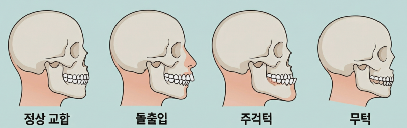 공덕 치과 치아 교정 치료 비용 부담 줄이기, 부정교합 실비 보험 혜택으로 가능할까?