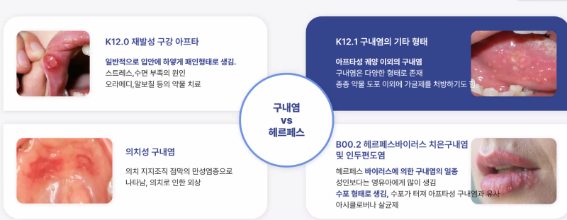 치과의사, 치과위생사 선생님들께 조금은 도움이 될, 치과보험 상병명 강의 간단 정리 - 재근....
