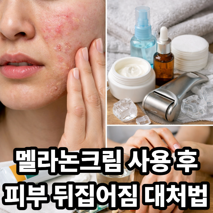  멜라논크림 사용 중 피부 뒤집어짐 대처법｜자극 반응부터 회복까지 완벽 정리