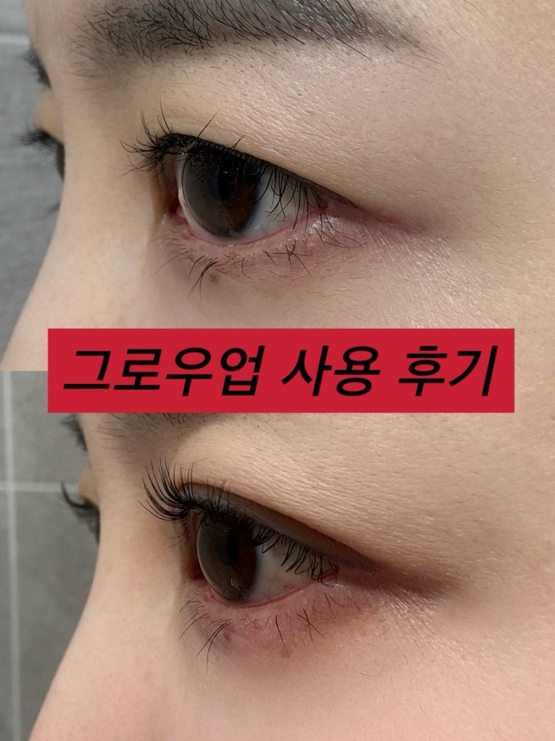 '오샤레 그로우업' 2개월 변화 내돈내산 후기