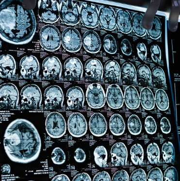 CT와 MRI, 왜 둘 다 필요할까? 환자가 알아야 할 이유