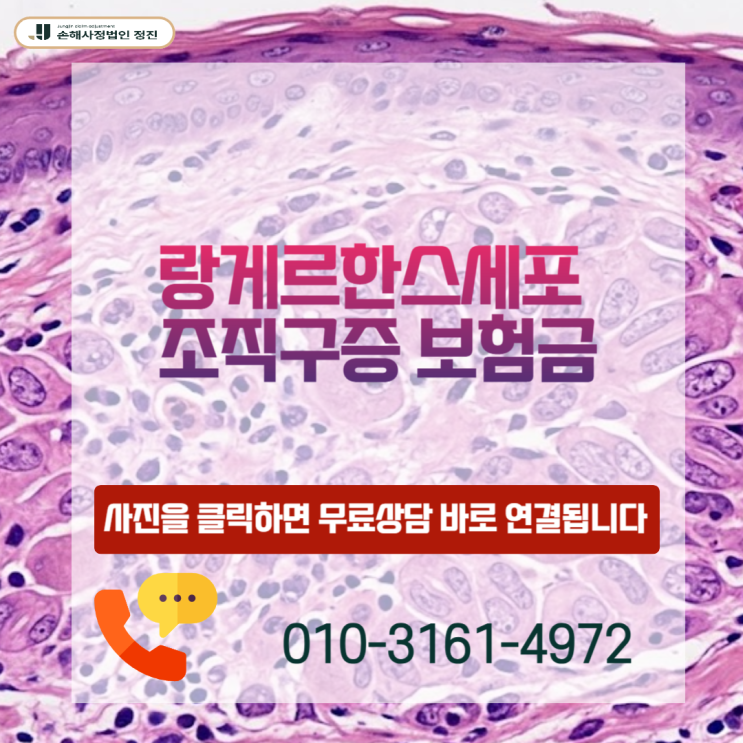  랑게르한스세포 조직구증 보험금, 거절된 암진단비 전액 수령하는 실전 전략