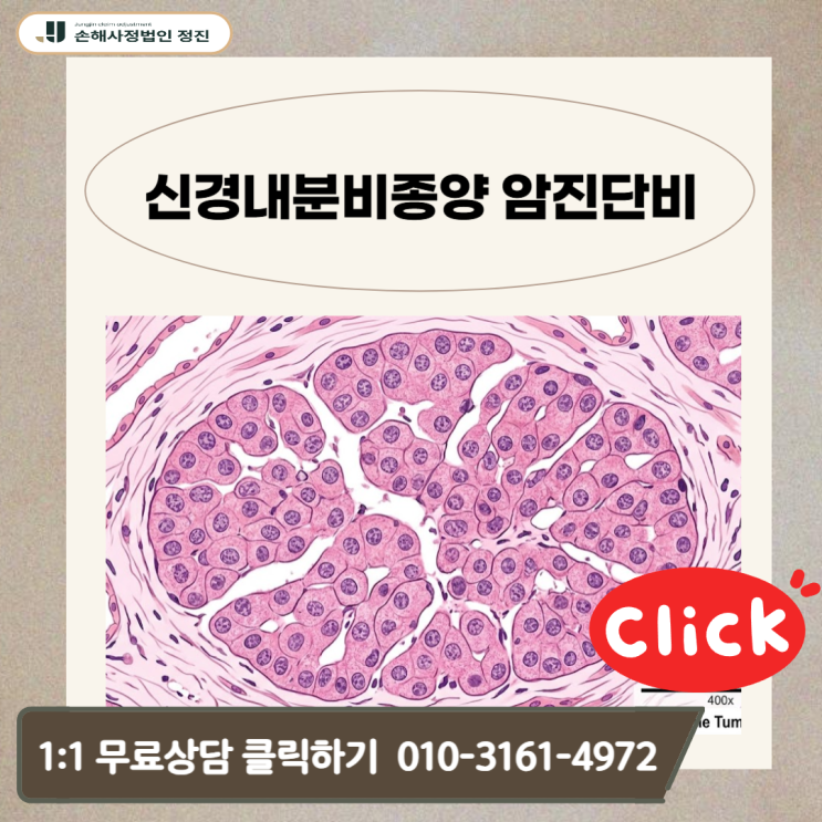  신경내분비종양 암진단비,  D37.5인데 20%? 전액 뒤집은 기준 공개