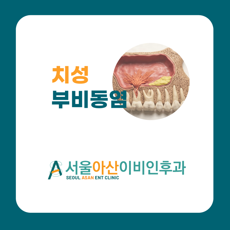 윗니 통증과 한쪽 코막힘, 냄새나는 콧물까지? '치성 부비동염' 원인과 치료법 [광진구 이비....