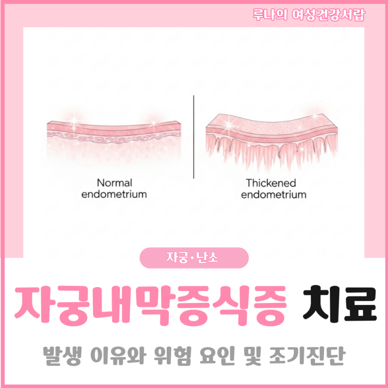 자궁내막증식증 치료 한 번의 선택이 결과를 바꿉니다