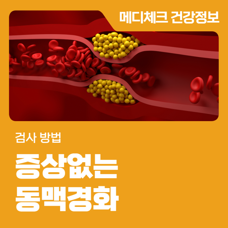인천건강관리협회 증상없는 동맥경화 검사 방법