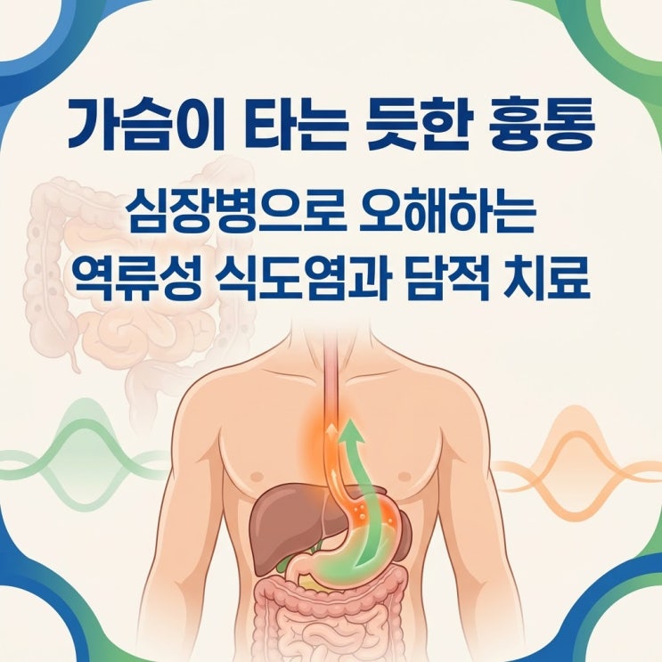  가슴이 타는 듯한 통증 쓰림, 역류성 식도염 증상 담적병 감별 및 심근경색 오해 한의원 치료