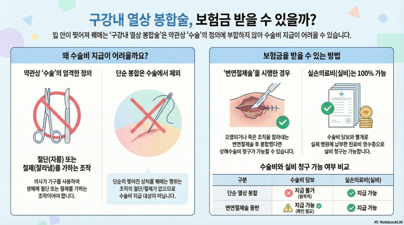 구강내 열상 봉합술, 보험금 받을수 있을까?