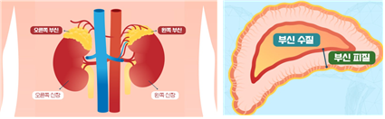비타민 C (출처: 이왕재교수의 비타민 C 이야기 )