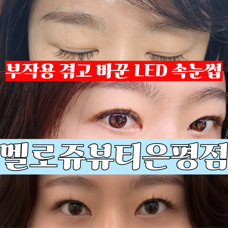 [연신내속눈썹] 멜로즈뷰티 은평점 한달 후기｜LED속눈썹 연장(부작용 경험자 리얼, 3일·7일·....
