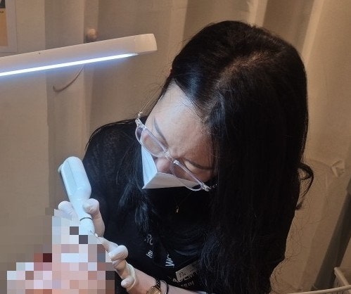 [대구비립종]대구 한관종 피지샘증식증 편평사마귀 비립종 쥐젖 관리하는 샵:)얼굴전체 스팟....
