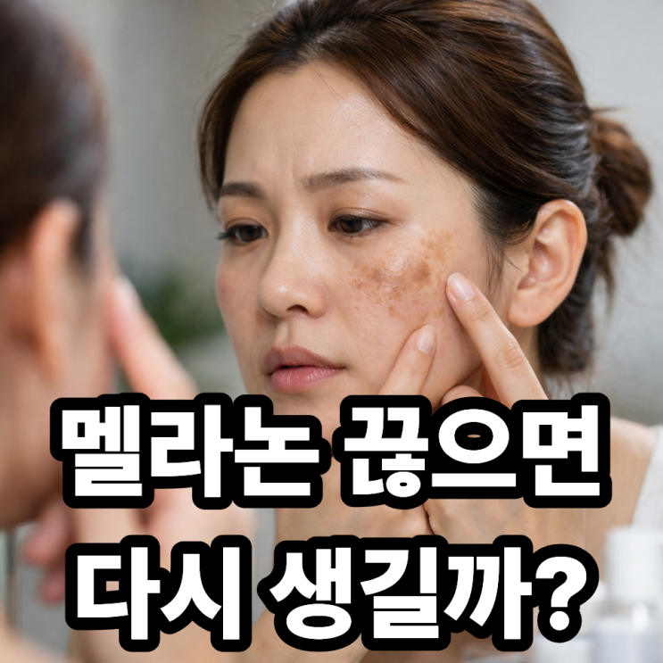  멜라논크림 사용 중단 후 재발 가능성 (현실 정리)
