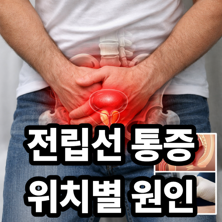 전립선 통증 위치로 알아보는 질환 구분 ️ 부위별 원인 정리