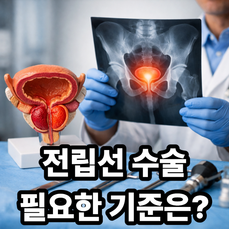  전립선 수술이 필요한 경우 기준｜언제 수술해야 할까? 꼭 알아야 할 판단 기준