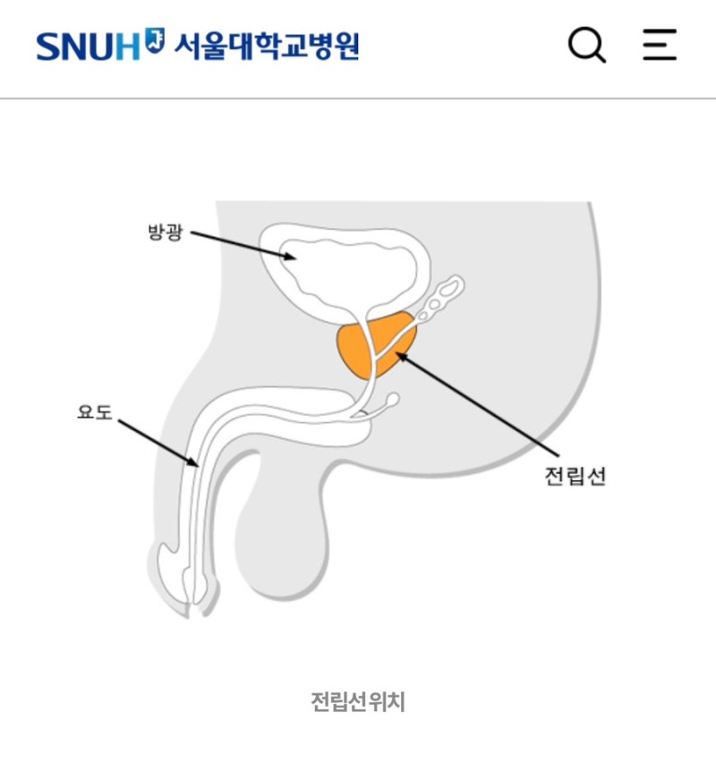 전립선 비대증, 왜 생기고 어떻게 치료할까? 원인·치료·예방 총정리