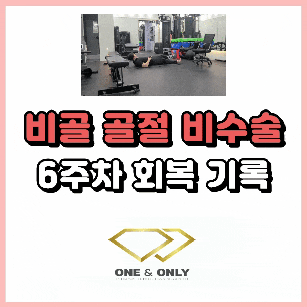 비골 골절 비수술 6주차 기록 : 발 딛기 연습 중이에요.