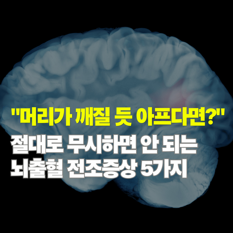  뇌출혈 전조증상 5가지, 골든타임을 살리는 초기 신호와 자가진단 체크리스트