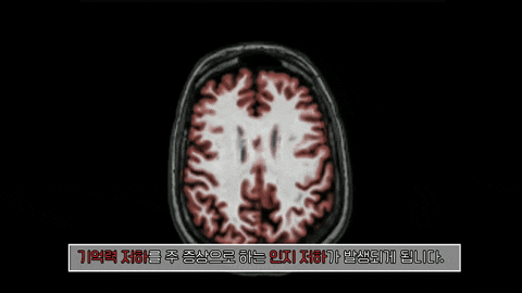 대전 재활병원 | 치매 초기 증상, 지금 확인 안 하면 늦습니다 - 치매 검사 · 치매 예방법 까....