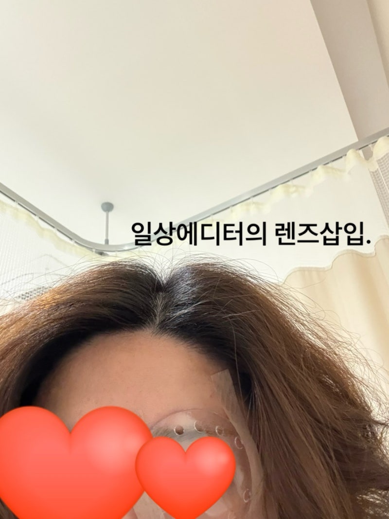 대구 메트로안과 렌즈삽입 3개월차 찐 후기 내돈내산✍️ 발품zip 공유(수술준비~후기)