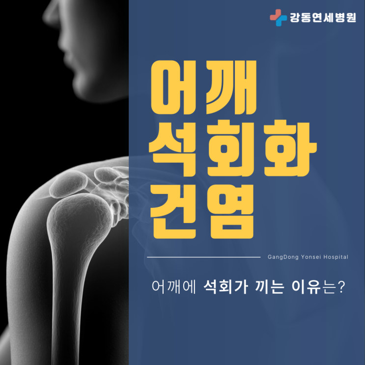  천호동 석회화건염 정형외과 어깨에 석회 끼는 이유, 그냥 방치한다면?