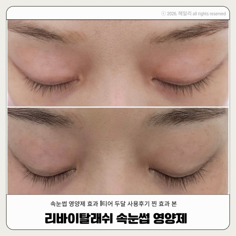 리바이탈래쉬 속눈썹 두달 후기 사용법 효과보장 내돈내산