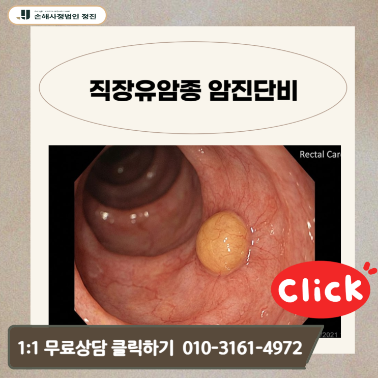  직장유암종 암진단비 C20인데 20%만? 보험사가 삭감하는 진짜 이유