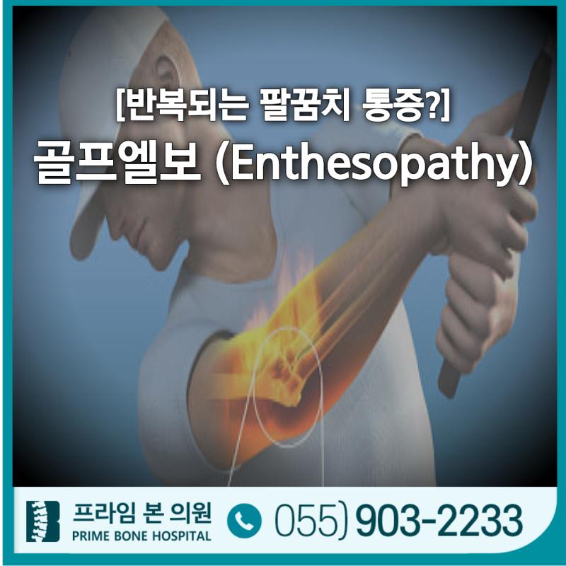 반복되는 팔꿈치 통증? 골프엘보 원인부터 치료까지 총정리